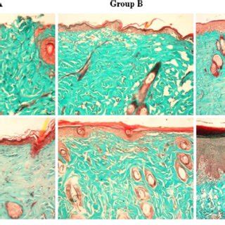 Masson Trichrome Staining Of Skin Sections From All Groups Group A