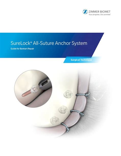 PDF SureLock All Suture Anchor System Zimmer Biomet 2020 01 13