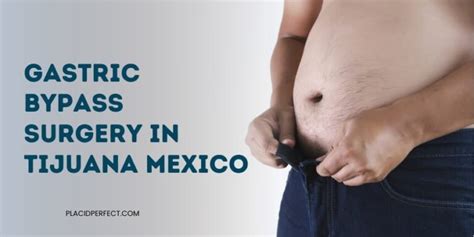 Affordable Gastric Bypass Surgery In Tijuana Mexico