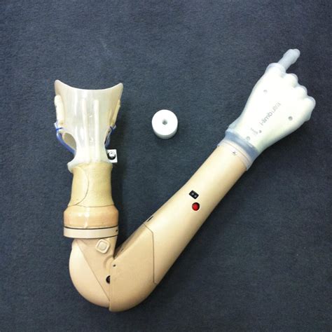 Osseointegration Archives - ProMotion Prosthetics