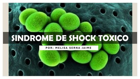 Síndrome De Shock Tóxico Melosa Udocz