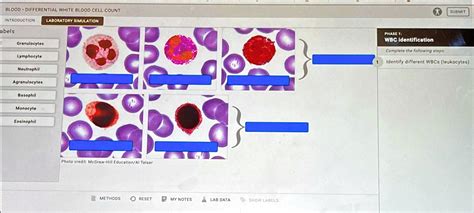 SOLVED: BLOOD - DIFFERENTIAL WHITE BLOOD CELL COUNT BLOOD-DIFFERENTIAL WHITE BLOOD CELL COUNT ...