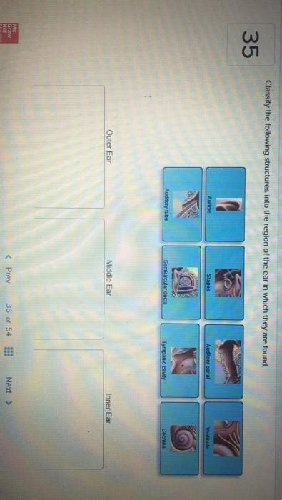 35 Classify The Following Structures Into The Region Of The Ear In Which They Are Found