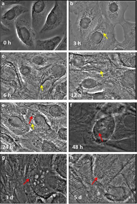 Keratinocyte Morphology At Different Time Points After 1 2 Mm Calcium Download Scientific