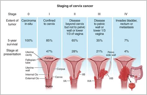 Cancer Surgery - Anil Cancer Clinic