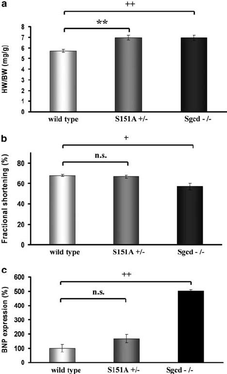 One Year Old Heterozygous S151a Knock In Mice Develop A Mild Dcm