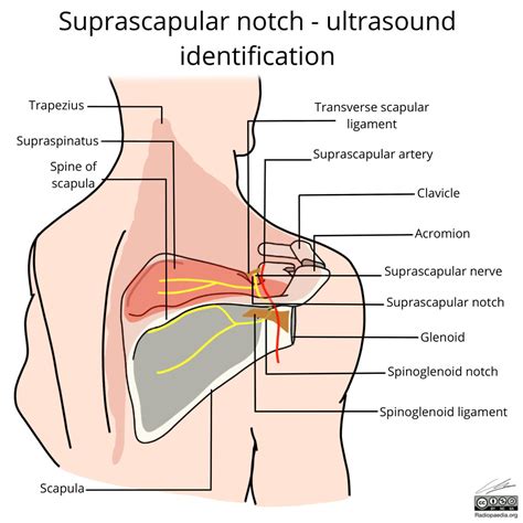 její Kolaps Zmírnit suprascapular nerve block Deter Vyloučit panna