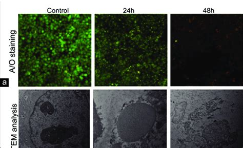 Allicin Induces Autophagy A Acridine Orange Staining For The Confi Download Scientific