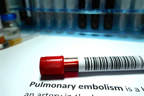 Prevalence Of Pulmonary Embolism Among Patients With Copd Hospitalised