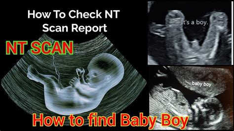 NT SCAN How To Find Baby S Gender In NT SCAN NT Scan Report