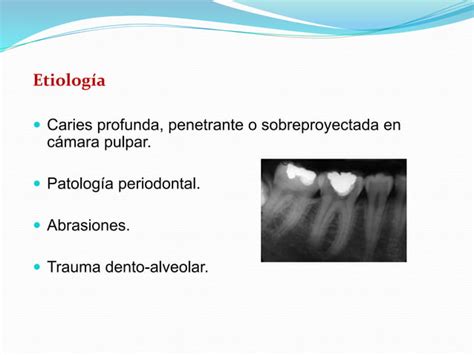 Diagnostico Pulpar Y Periapical Endo Pptx