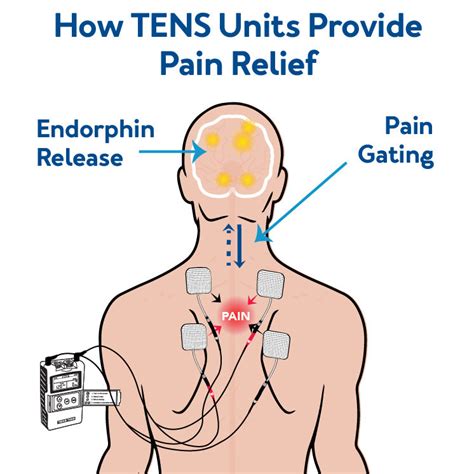 How To Use A Tens Unit A User Friendly And Simplified Guide Carex