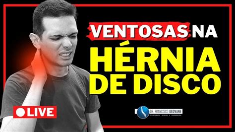 Ventosaterapia Como Tratar H Rnia De Disco Usando As Ventosas Youtube