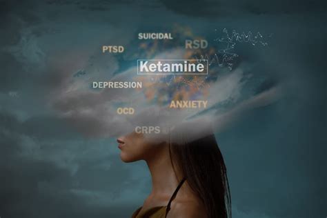 Ketamine Infusion Therapy Global Med