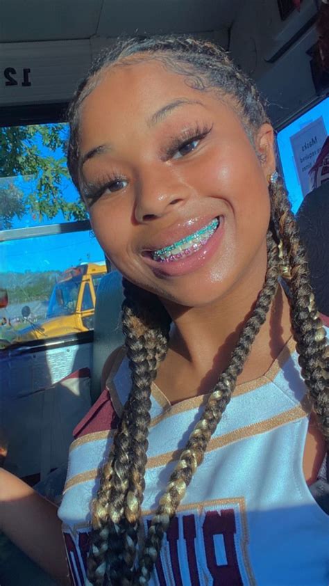 Pinmelanininterest 🤎 Braces Colors Braces Tips Getting Braces