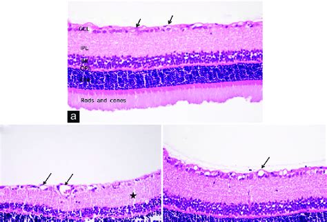 A Light Microscope Image Of A Healthy Group Rat Retina H And E