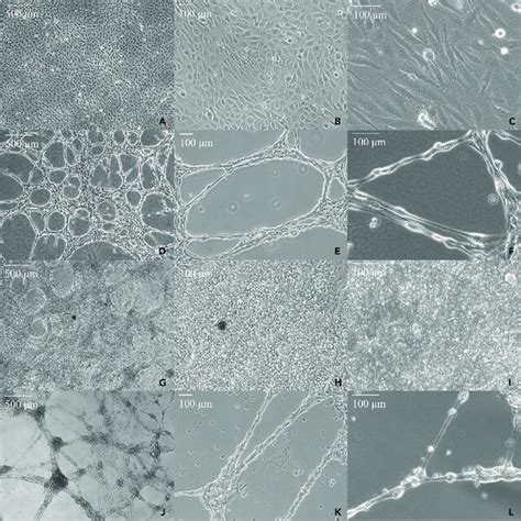 Morphology Of Purkinje Like Cells Differentiated With The Download