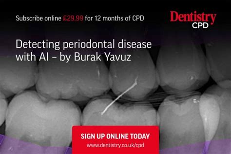 Detecting Periodontal Disease With Ai Dentistry