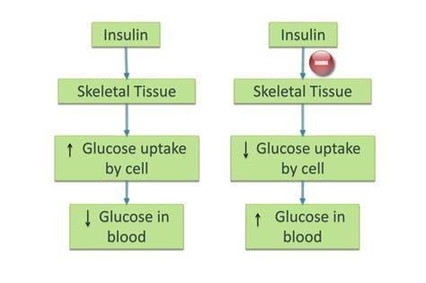 Diabetes Mellitus | Classification , Etiology , Pathogenesis , Complications