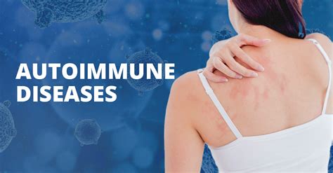 What You Need To Know About Autoimmune Disorders