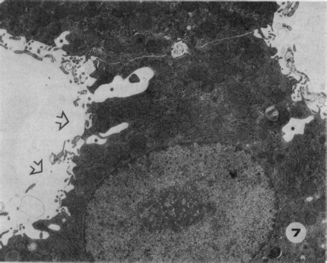 Pores And Fenestrations In A Sinusoidal Endothelial Cell From The