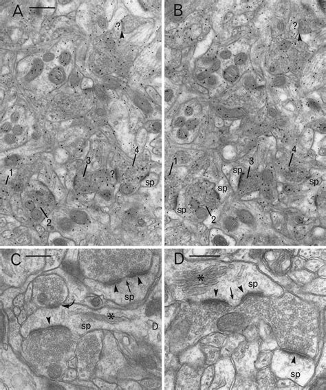 A B Pair Of Electron Micrographs Taken From Serial Sections Through