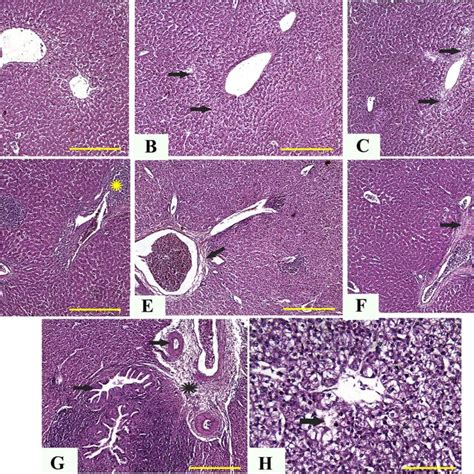 Representative Photomicrographs From The Spleen Of Broilers Treated