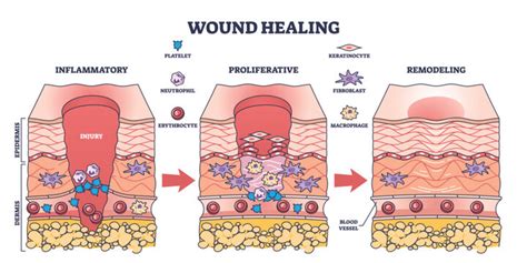 wound healing steps