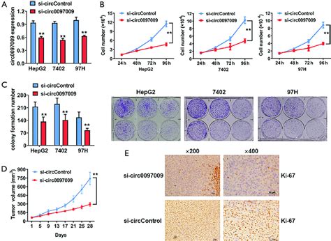 Knockdown Of Circ0097009 Inhibits Hepatocellular Carcinoma Tumor