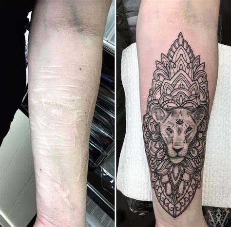 Tattoos To Cover Scars On Legs