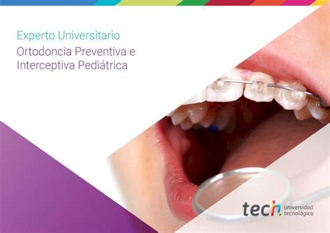 PDF Experto Universitario Ortodoncia Preventiva E Interceptiva