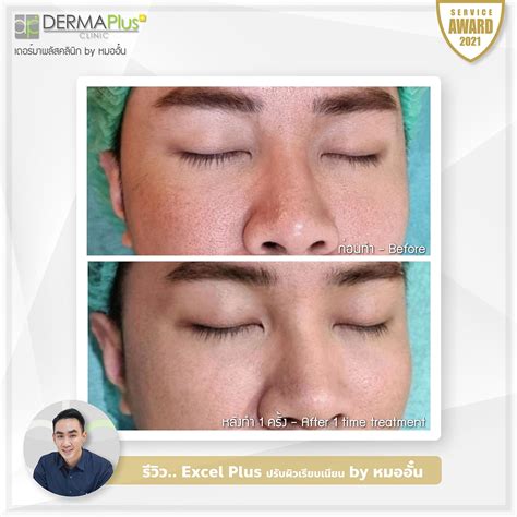 Review Excel Dermaplus Clinic Phuket By