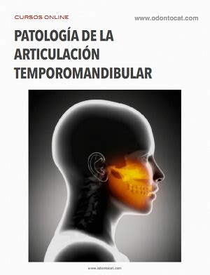 Odontocat Cursos Online De Odontolog A