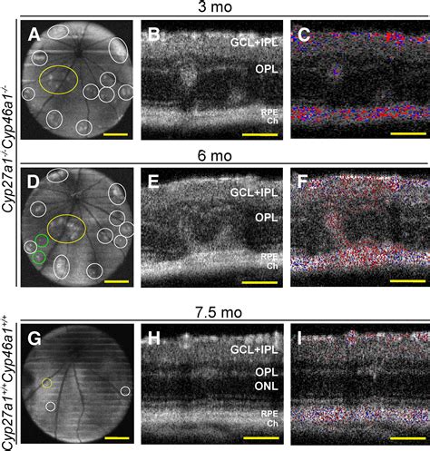 Retinal And Nonocular Abnormalities In Cyp27a1−−cyp46a1−− Mice With