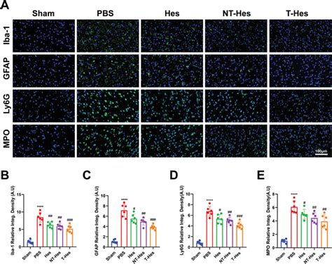 Hesperetin Nanoparticles Regulate Tbi‐induced Expression Of Iba‐1