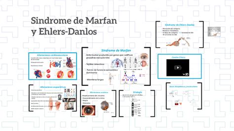 Sindrome De Marfan Y Ehlers Danlos By Lucas Wittstatt