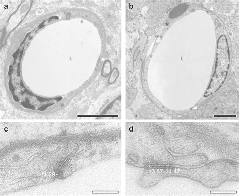 A B Low Power Electron Micrograph Of Two Blood Vessels In Normal A