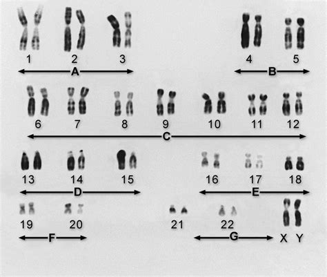 Genes and Chromosomes - Fundamentals - MSD Manual Consumer Version