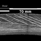 Example Of An Extended Field Of View Efov D Ultrasound Image The