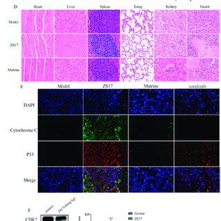 Zs Inhibited Tumor Growth In Human Hepg Xenograft Nude Mouse Model