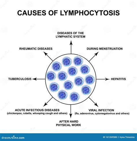 Causas De Linfocitosis Aumento De Linfocitos En La Sangre Asesinos De