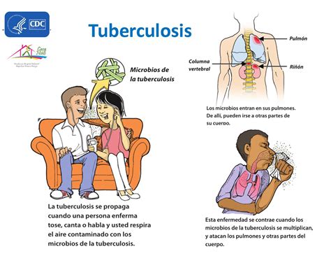 Tuberculosis ¿qué Es Y Cuáles Son Sus Síntomas Fundación Hospital Infantil Napoleón Franco