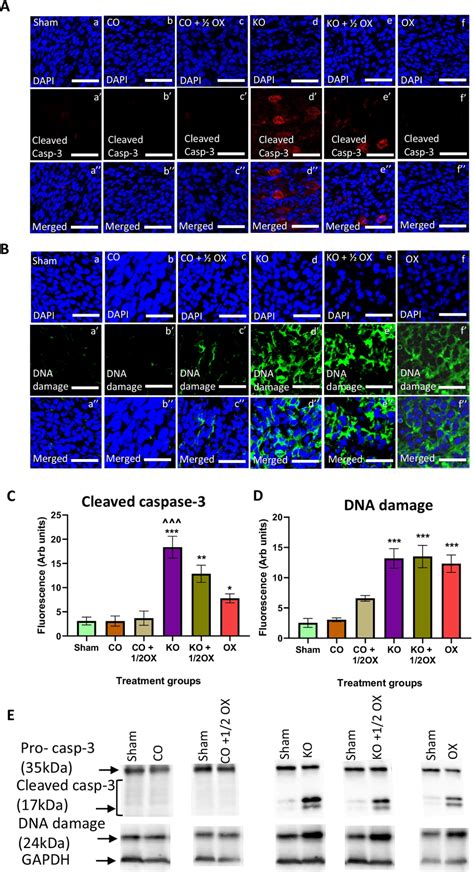 Expression Of Cleaved Caspase 3 And Dna Damage Following Treatments