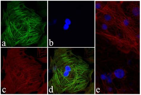 Anti Cardiac Troponin I Antibody Rp Ab Abcam