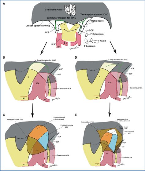 A Relationship Between Neurovascular Structures And Bony Anatomy Of