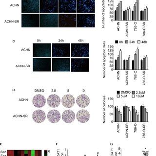 LncRNA CCAT1 Expression Increases In Sunitinib Resistant RCC A The