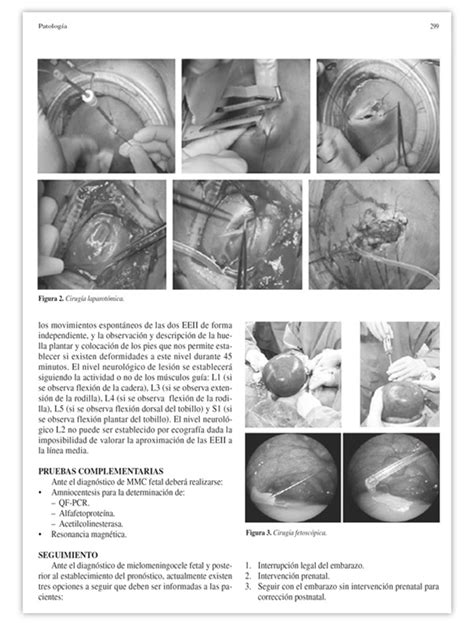 Protocolos De Medicina Materno Fetal Perinatolog A Edici N Ergon