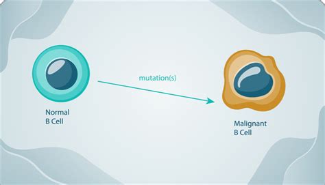 What is CLL/SLL? | VENCLEXTA® for Untreated CLL/SLL