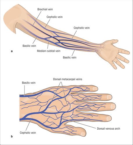 Introduction To Cannulation Principles And Techniques Edulearn