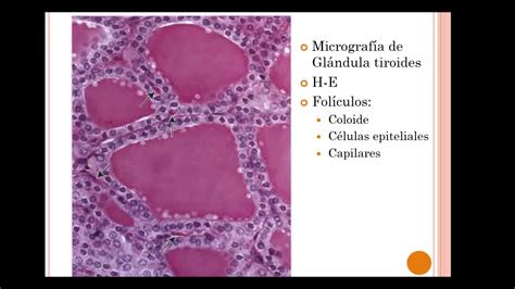 Histologia De Tiroides Youtube